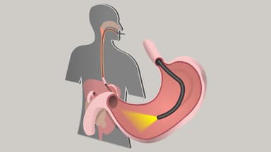 Nội soi tiêu hóa gồm những gì, khi nào cần nội soi tiêu hóa?