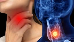 Nang tuyến giáp 4mm đã cần mổ chưa? Giải pháp điều trị phù hợp