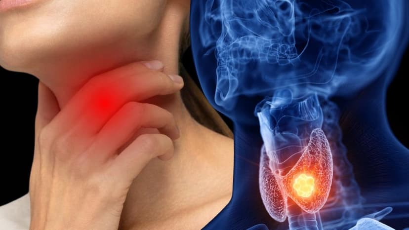 Nang tuyến giáp 4mm đã cần mổ chưa? Giải pháp điều trị phù hợp
