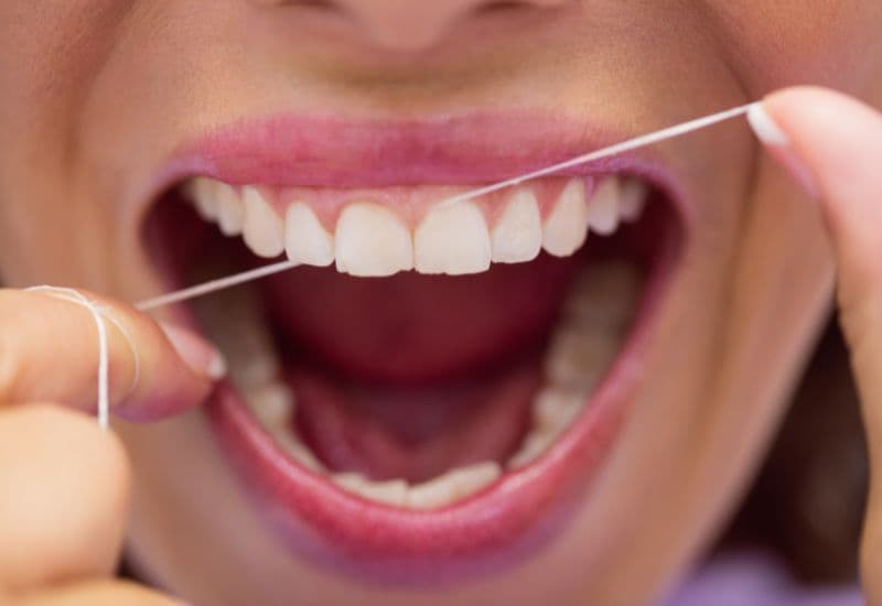 quy trình làm răng bắc cầu