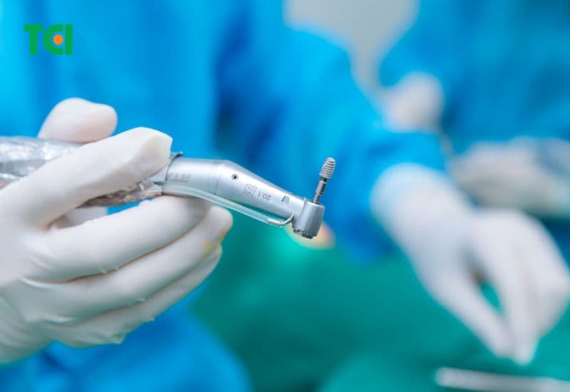 quy trình trồng răng implant chuẩn y khoa