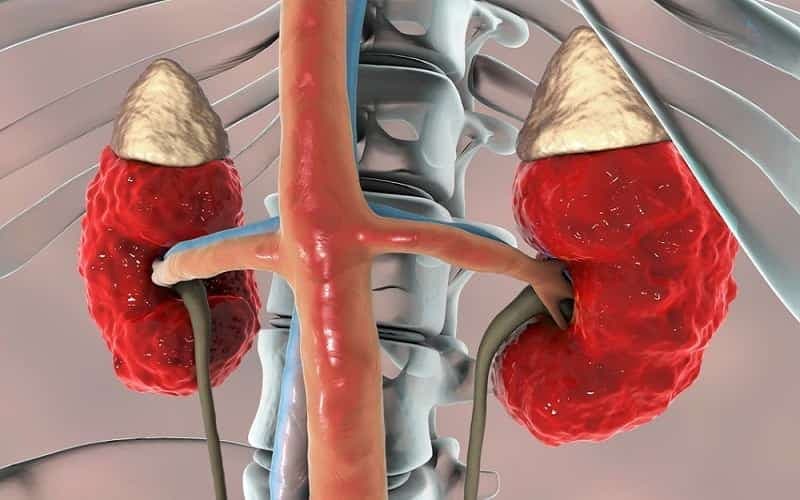 người suy thận có ăn được khoai sọ không