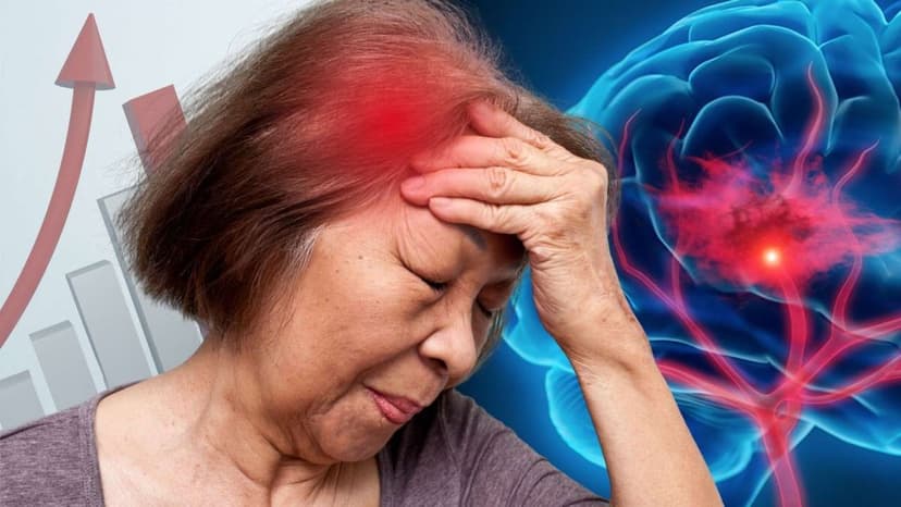 Thang điểm đánh giá nguy cơ đột quỵ