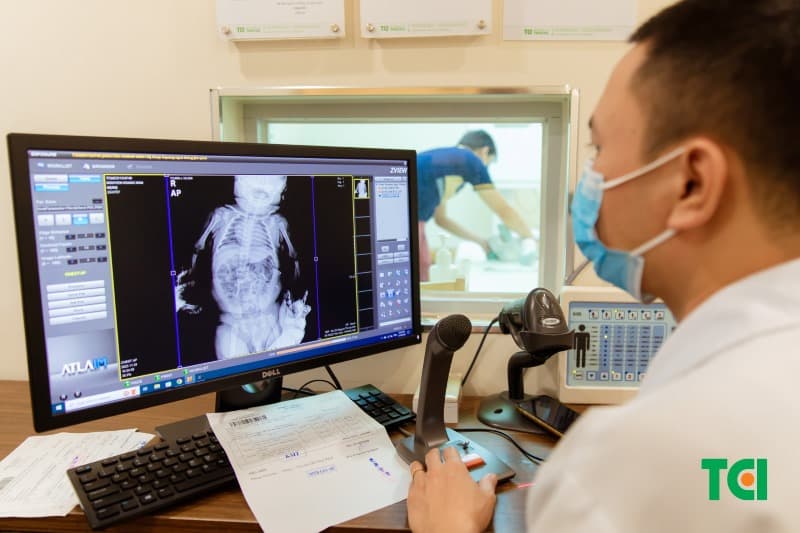rẻ sơ sinh bị tuyến giáp có nguy hiểm không