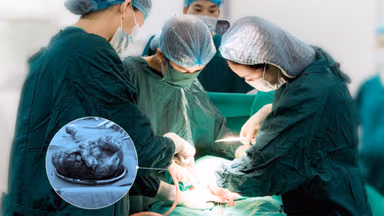 Khối u xơ tử cung nặng gần 3kg và hành trình xử trí an toàn tại TCI