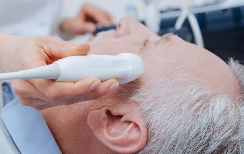 siêu âm doppler xuyên sọ để làm gì