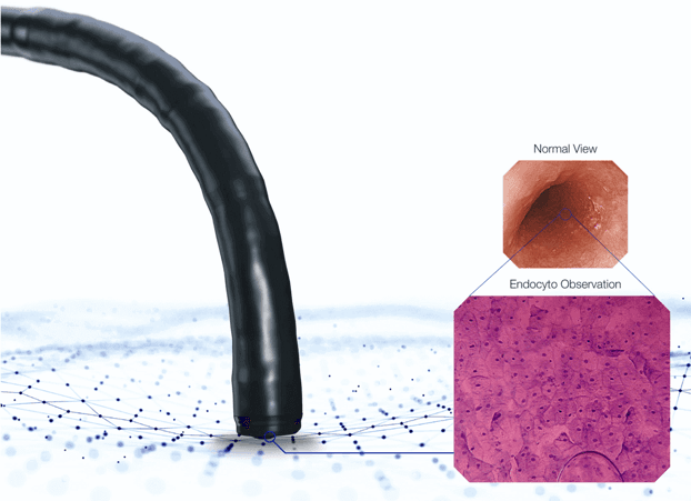 Endocytoscopy là công nghệ cho phép quan sát tổn thương ở cấp độ tế bào