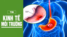 Hướng đi nào trước gánh nặng ung thư đường tiêu hóa tại Việt Nam?
