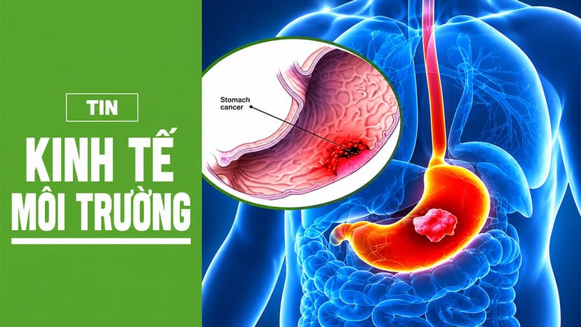Hướng đi nào trước gánh nặng ung thư đường tiêu hóa tại Việt Nam?