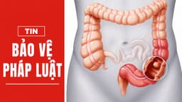 Nội soi định kỳ – “Vũ khí số 1” trong cuộc chiến chống ung thư tiêu hóa