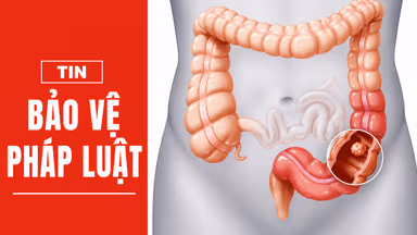Nội soi định kỳ – “Vũ khí số 1” trong cuộc chiến chống ung thư tiêu hóa