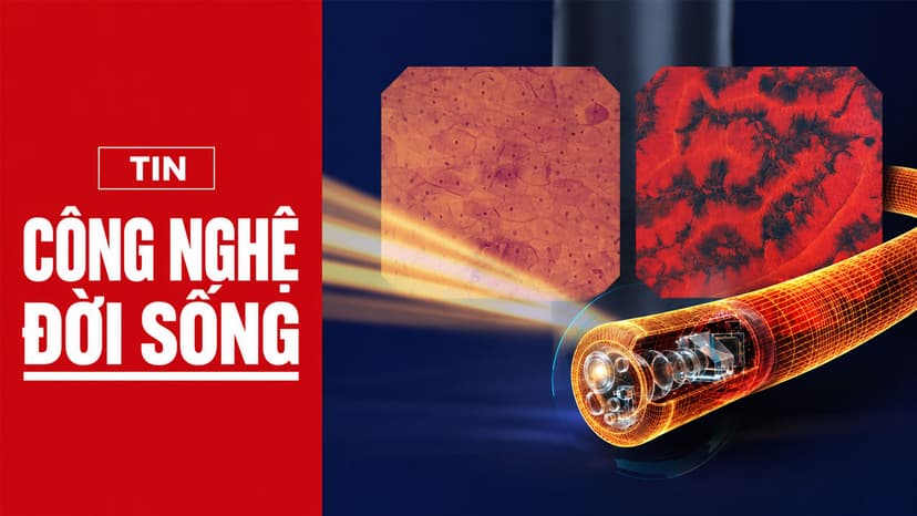Siêu nội soi Endocyto 520x đánh dấu bước ngoặt trong nội soi tiêu hóa