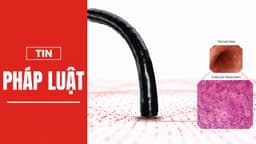 Siêu nội soi Endocyto 520x qua lăng kính nghiên cứu quốc tế