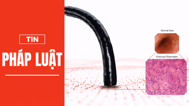 Siêu nội soi Endocyto 520x qua lăng kính nghiên cứu quốc tế