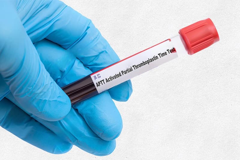 thời gian thromboplastin là gì
