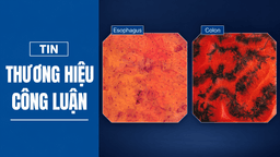 Triết lý ‘Thấy rõ hơn, tìm sớm hơn, điều trị an toàn hơn’ trong nội soi tiêu hóa
