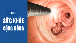 Ung thư đại trực tràng: Cơ hội vàng từ tầm soát sớm