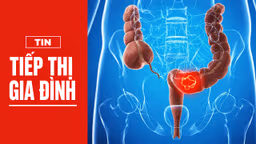 Từ polyp đến ung thư: Hành trình 10 năm có thể ngăn chặn