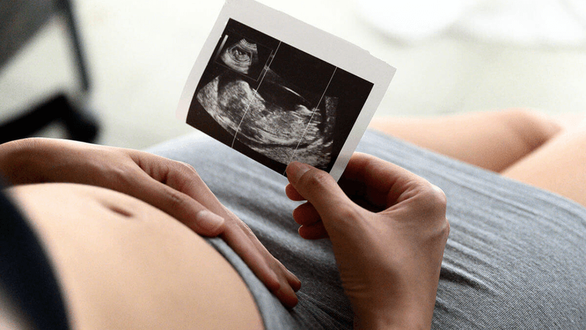 Cách đọc kết quả xét nghiệm Double Test