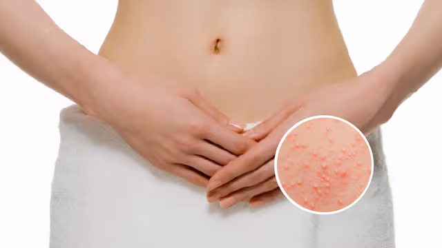 Cách trị viêm nang lông vùng kín