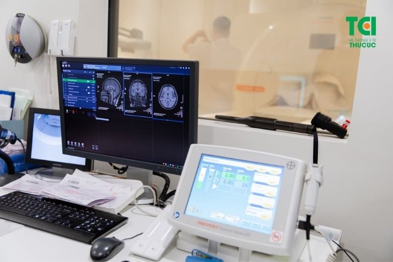 Giải đáp vì sao đau đầu vùng trán và đỉnh đầu