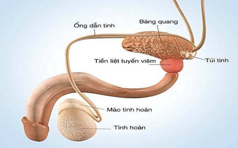 viêm tuyến tiền liệt