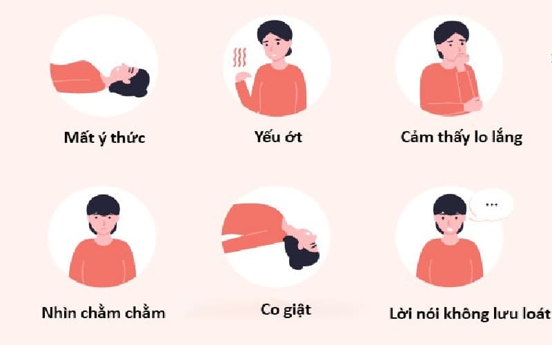 Dấu hiệu bệnh động kinh ở trẻ em