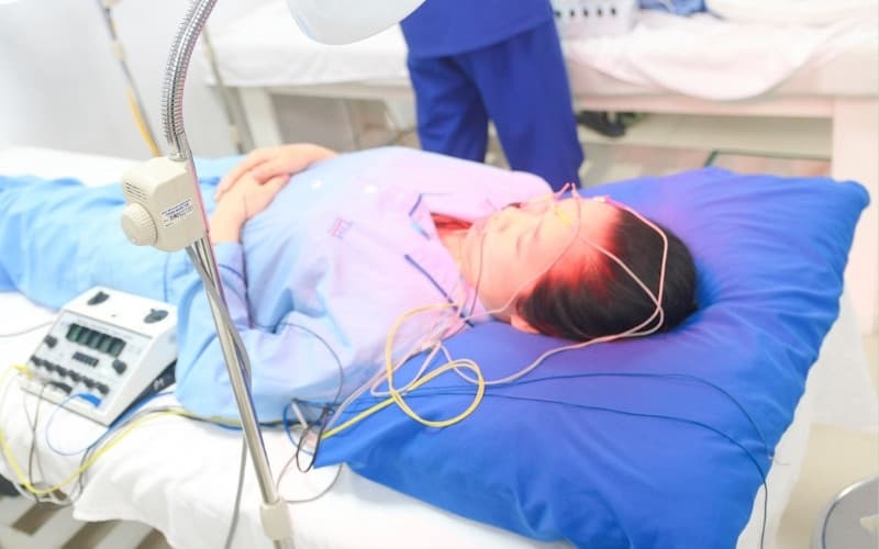 châm cứu liệt mặt