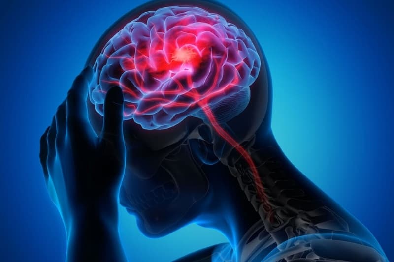 Giải đáp vì sao đau đầu vùng trán và đỉnh đầu