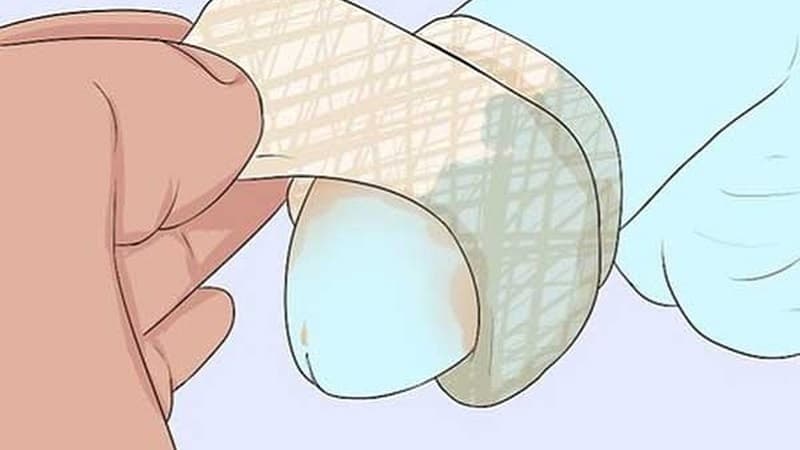 cắt bao quy đầu có đau không
