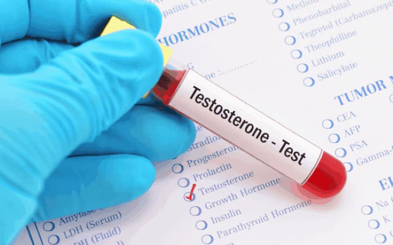 chỉ số testosterone của nam giới