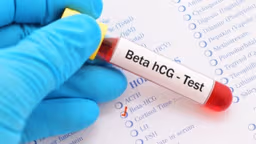 Giải đáp:Chỉ số beta hcg thai ngoài tử cung là bao nhiêu?