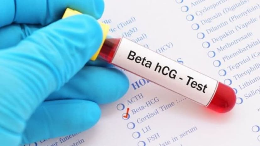 Giải đáp:Chỉ số beta hcg thai ngoài tử cung là bao nhiêu?