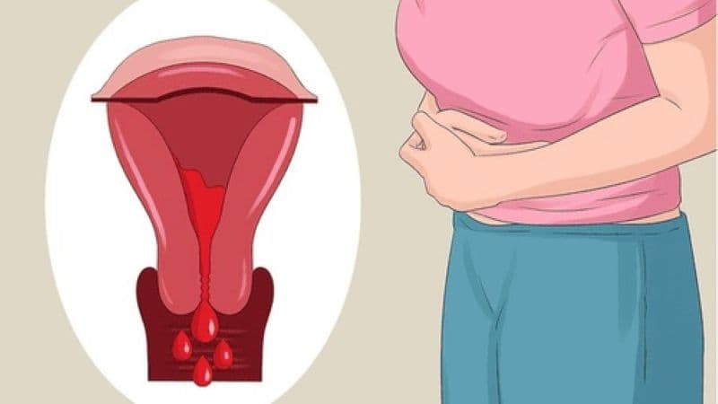 Tiêm thuốc thai ngoài tử cung ra máu bao lâu?