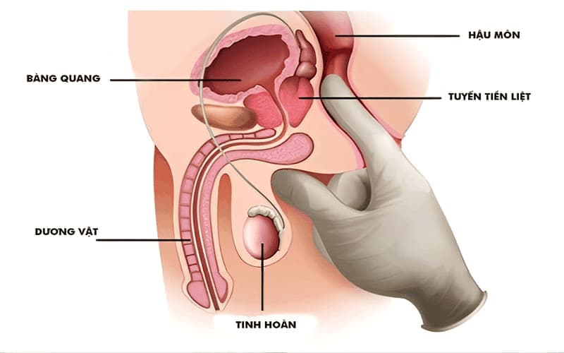 tuyến tiền liệt