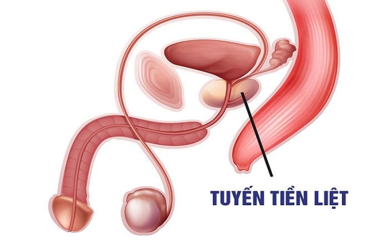 tuyến tiền liệt