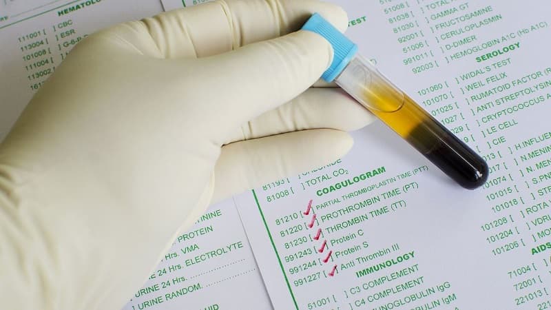 thời gian thromboplastin là gì