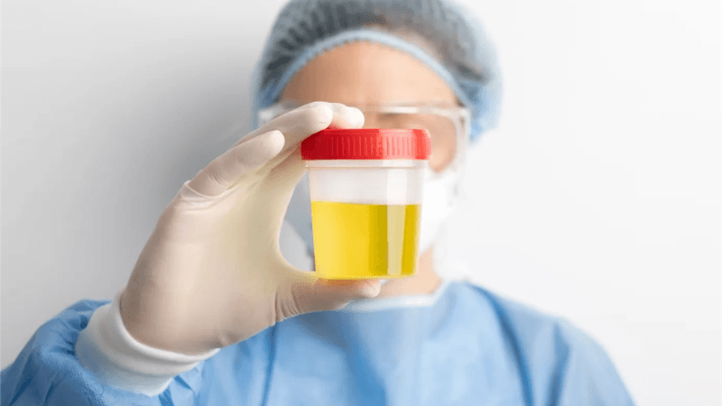 xét nghiệm nước tiểu có biết viêm phụ khoa không