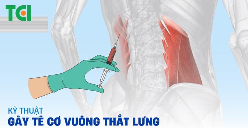Kỹ thuật gây tê cơ vuông thắt lưng là phương pháp giảm đau hiệu quả sau phẫu thuật vùng bụng.