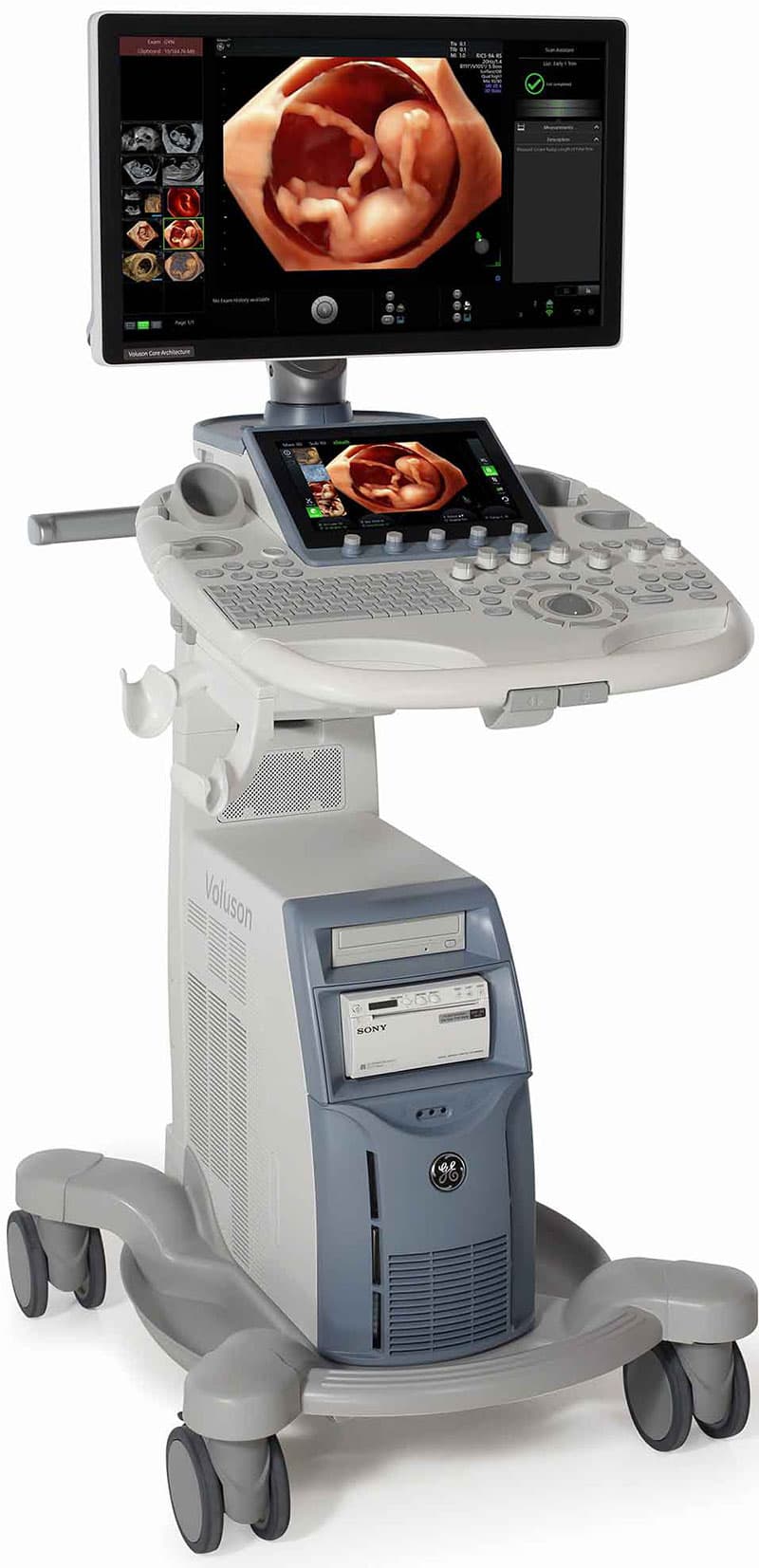 Máy siêu âm Voluson S8 và S8t của GE HealthCare l