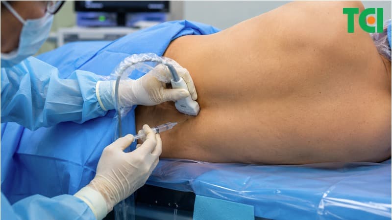 Siêu âm đóng vai trò quan trọng trong quy trình thực hiện QLB.