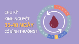 Chu kỳ kinh nguyệt 35-40 ngày có bình thường không?