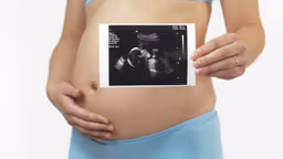 Chu vi vòng bụng thai nhi tuần 18 bao nhiêu?