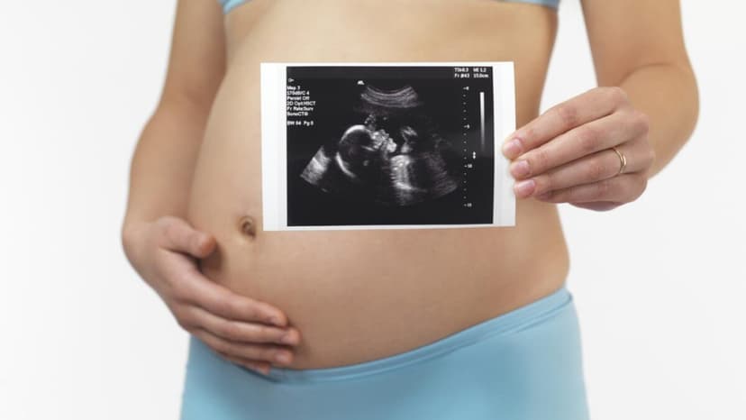 Chu vi vòng bụng thai nhi tuần 18 bao nhiêu?