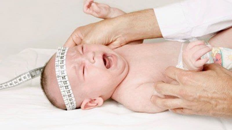 dấu hiệu u não ở trẻ em