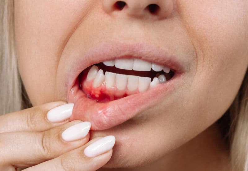 dấu hiệu tụt lợi