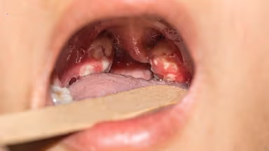 Mách bạn địa chỉ điều trị bệnh lậu ở Đại Từ uy tín, kín đáo