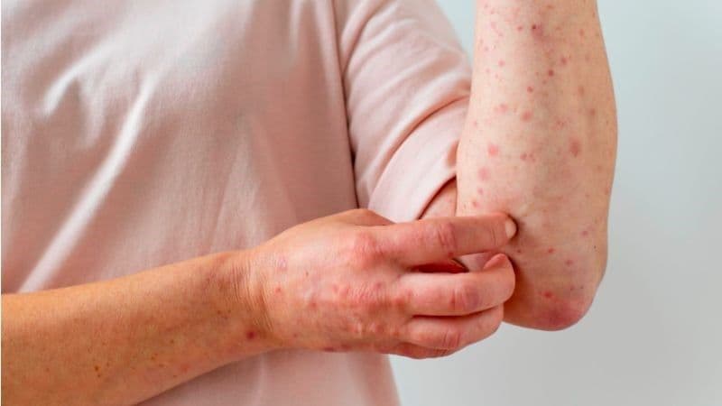 Điểm danh các bác sĩ giỏi chữa giang mai ở TCI Đại Từ