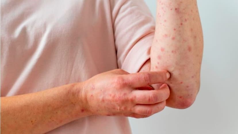 Nên khám giang mai ở Thanh Trì tại đâu chính xác và kín đáo?