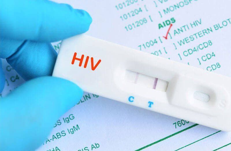 khám HIV